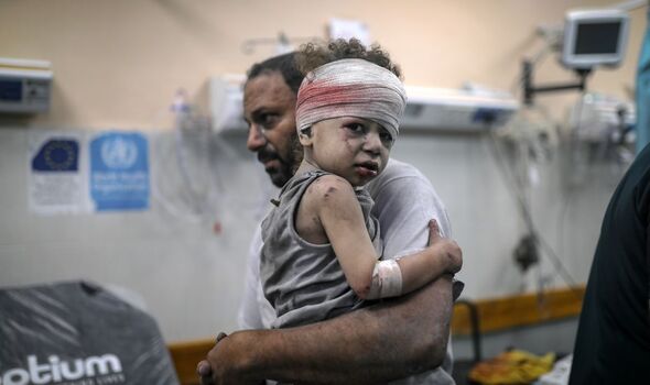 A Palestinian child with wounds following an attack